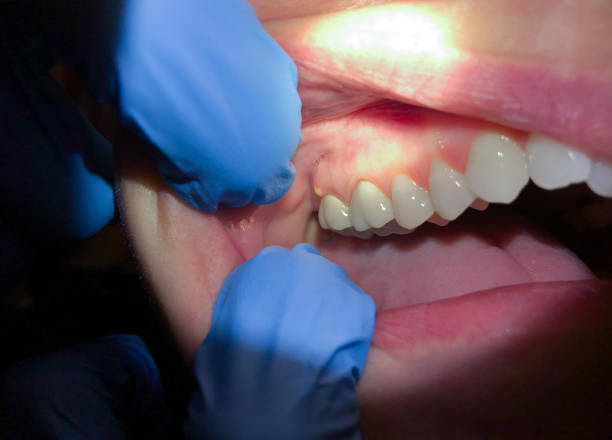 Best Emergency Cosmetic Dentistry in Baidland, PA